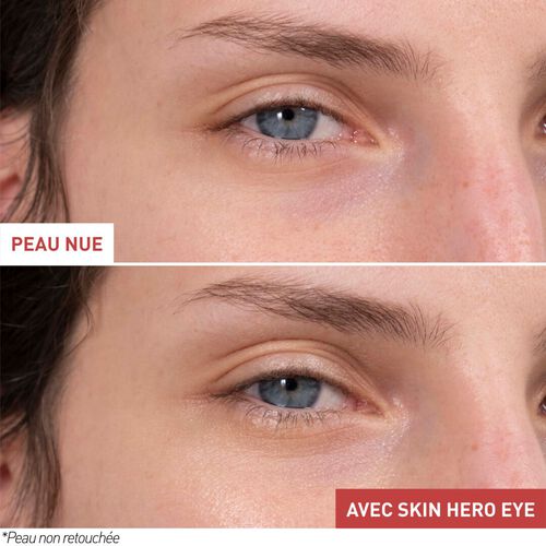 Agrandir la vue3/7 de Skin Hero Eye, , FR